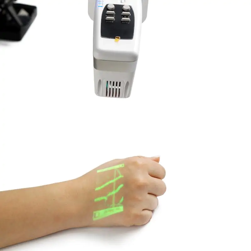 Предзаказ на аппараты визуализации вен по специальным ценам